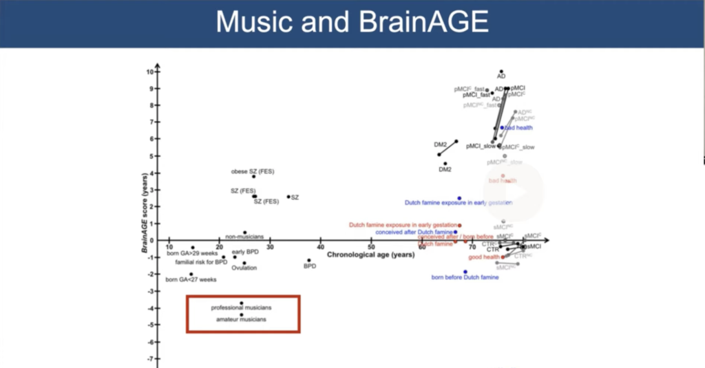 musicians younger looking brains